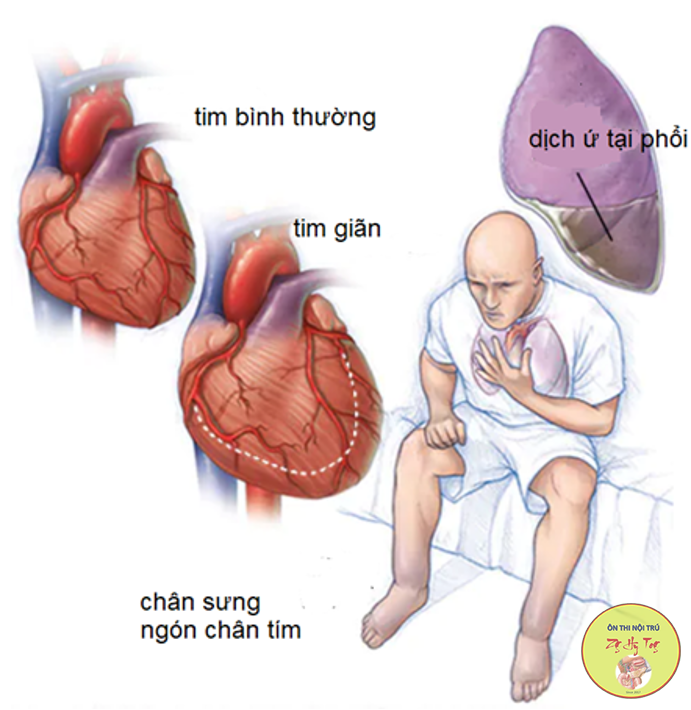 VIẾT