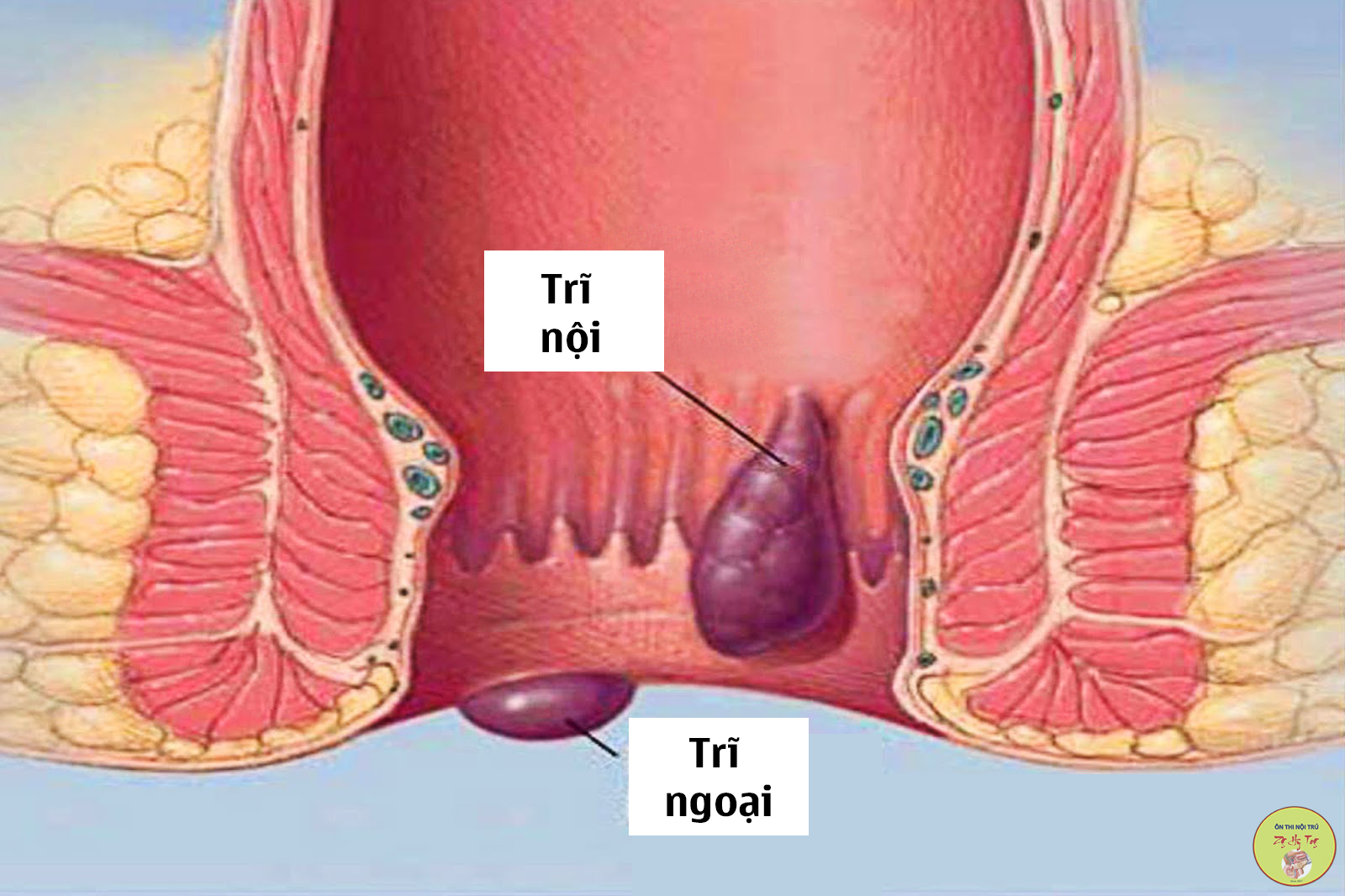 TRĨ